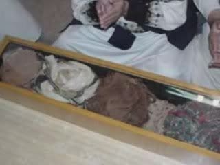 bekam,reflexi,gurah,ear candle,hijamah,herbal,islami
